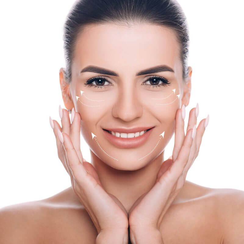 Wektory na twarzy kobiety pokazujące efekt zastosowania biostymulacji kwasem hialuronowym i hydroksyapatytem wapnia. Poprawa owalu twarzy i uniesienie kącików ust botoksem.