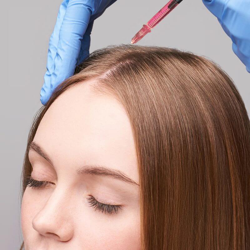 Lekarz wykonuje zabieg mezoterapii igłowej kobiecie na wypadanie włosów w Błoniu i w Warszawie.