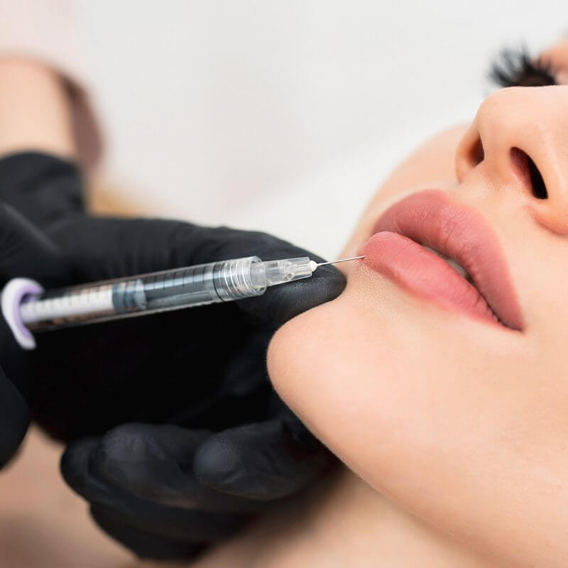 Lekarz medycyny estetycznej wykonuje na kobiecie zabieg powiększania ust kwasem hialuronowym w Błoniu i w Warszawie.